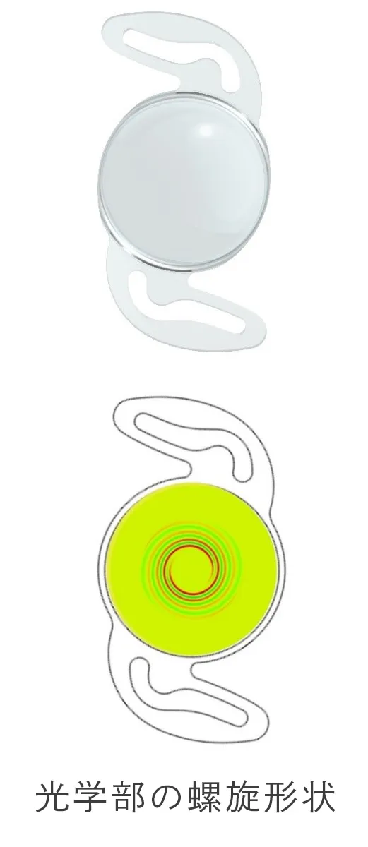 RayOne Galaxy眼内レンズを用いた白内障手術について
