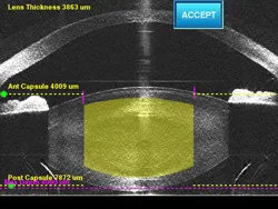 True Guided-Image surgery